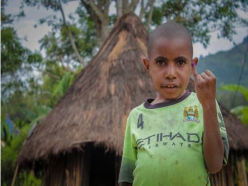 Child showing he has been vaccinated against polio